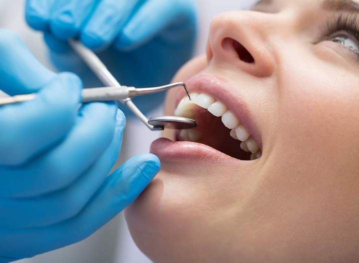 Teeth Bleaching Toronto