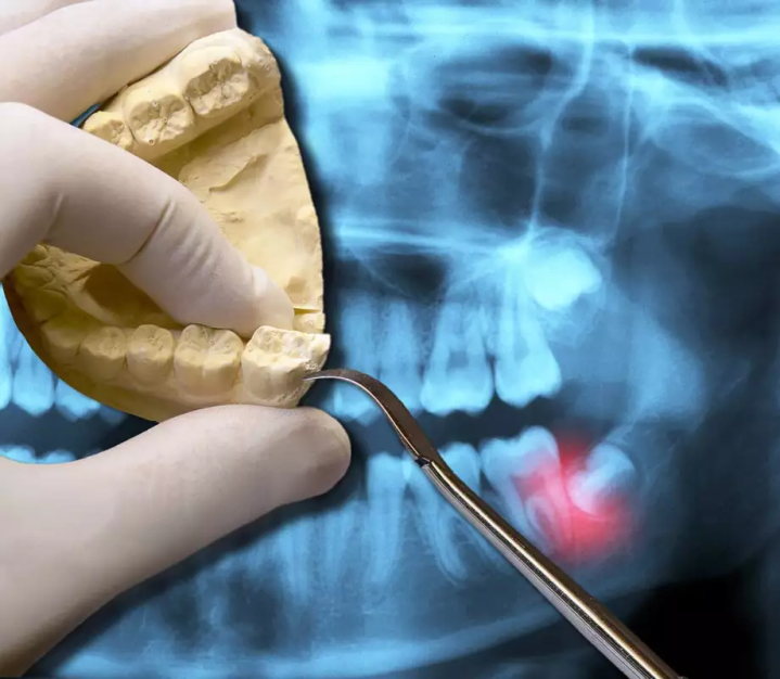 TMJ is a common problem affecting the jaw joint movement and normal functions like chewing, talking or yawning.