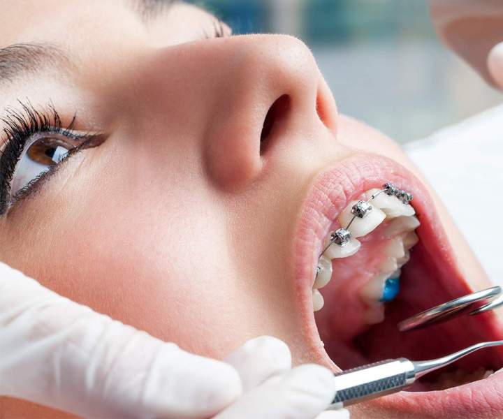 Dental Services Toronto